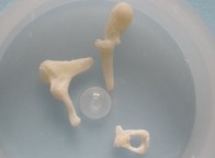 Set of Ossicles.